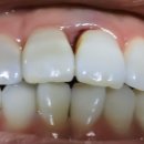 사랑모아치과의원 이미지