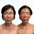이야에스테틱