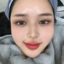 뷰커스의원 강서가양, 온다리프팅 후기