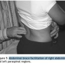 abdominal bracing 테크닉. 크레이그 리벤슨. 정리중 이미지