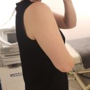 (주)강변 | [강변] 지분주 4회차까지 맞아 본 리얼 변화후기. 지방분해주사