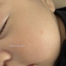 일센치 - 전주시 덕진구 오송1길 7 | 신생아 태열 정복 후기! (일센치 약모밀 내돈내산)