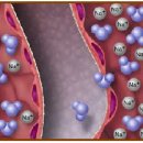 부종의 발생기전, 부종의 원인 이미지
