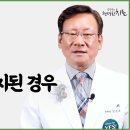 삼중음성 유방암 말기도 완치되는 경우가 있다 이미지