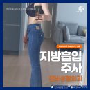 엔비바디