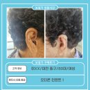 문화동경로당 | 대전 오티콘 보청기, 이 XX 고객님 오티콘 인텐트 1 구매후기(80대, 女)