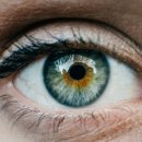 미노성형외과의원 | 쌍꺼풀 꼭 수술해야 예쁜가요 쌍꺼풀에 대한 A to Z