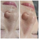 피부맑음 이미지