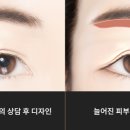 라이블리성형외과의원 이미지