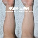 1474 | 노원역화이트태닝샵 추천 야간,연중무휴 직장인도 이용하기 편한곳 [벗고탠노원점]