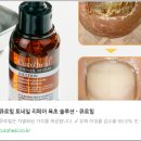 차고치는집 | 발톱무좀 완치? 집에서 돈 안 들이고 없애는 초간단 후기