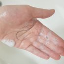 아가방 순여성병원점 | 여성탈모병원 피부과