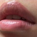 하진뷰티 | 에이샵뷰티 후기 아라원장님 오버립 립라인 확장 통증 가격 탈각