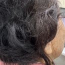 명일밧데리 | 포낙보청기 인피니오 스피어 구매 사례│편측성 난청 어르신의 만족 후기