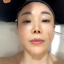 포항시북구20 | 포항북구피부 디톡스 맛집 더나은스킨 솔직후기