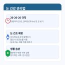 렌즈포유 이미지