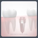 서울가족치과기공소 이미지