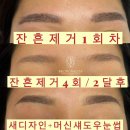 브로우날다 이미지