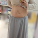 아랫배 안빠진다면? 홍대피부과 유팻 바디지방분해주사 후기