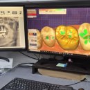 열린치과기공소 이미지