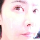 바름미장원 | 청담동 자연유착쌍꺼풀 수술 3개월후기
