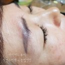 아이애드 이미지