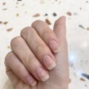쏭톱네일
