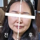 비에이치티스파 이미지