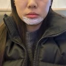 필러 스튜디오 | [내돈내산] 양재역 도곡동 피부과 턱 필러 전후 후기