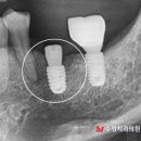 끄떡끄떡 이미지