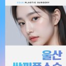 제우스성형외과의원 네이버블로그