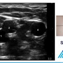 08 Vascular Access 이미지