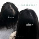 정수정헤어 | 20대 여성 가르마 탈모, 부천에서 완벽 해결!