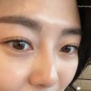 온아한의원 | 대구 월성동 속눈썹 :D 유천동 속눈썹 펌 잘하는 케어데이 방문 후기! (feat. 케어블랙틴트펌 )