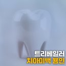 트리베일러(Baylor)치과의원 | 용인 치아미백 "트리베일러"에서 덴탈 에스테틱으로 환한 미소 만들기