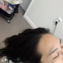 준 헤어라인 - 성북구 | 인천 미작뷰티)헤어라인 반영구 내돈내산 솔직 후기