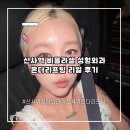신사역 비올라셀 성형외과에서 부모님 온다리프팅 일주일차 리얼 솔직 후기