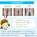 위대항맥외과의원 네이버블로그
