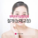 뷰티아이
