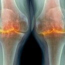 아산중앙연합의원 이미지