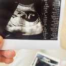 순풍한의원 | [임신일기] 동탄 미즈파크 산부인과 네 번째 진료 후기(feat.미즈파크산후조리원 상담 및 예약)