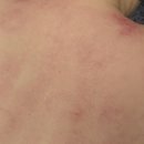 스타 바디핏 | 인스타광고템 바디컷튠핏 V2 더현대팝업 근막마사지기 흡입괄사 내돈내산 후기