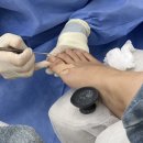 고덕역 | [강동구] 내성발톱 관리 푸스케어 고덕역 후기