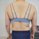 [수원] 예신 팔 무한람스 3개월 총정리 (88사이즈 -&gt; 66사이즈 만든 후기 / 병원 정보