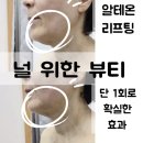 태양메디칼 | [대구 북구 칠곡 알테온 리프팅] 대구피부관리로 탄력 회복한 후기 널 위한 뷰티