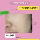 윤메디팜 | 시아플렉스 밤, 정말 이거 만능재생 크림? 판매하면서도 놀라는 일 많은 시아플렉스 밤