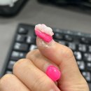 디앤써피부과의원 | 보라매 피부과 추천| 디앤써 피부과 손톱사마귀 치료후기 1탄..