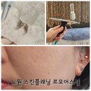 룡스네일 | 노원 스킨플래닝 르모어스킨