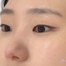 누벨르브로우 이미지