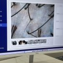 오지공 | [모바이오 일산점] 일산 두피 관리, 직접 받아본 솔직 후기!